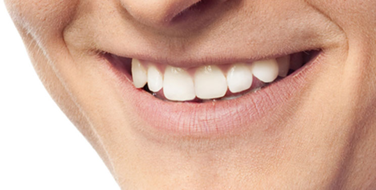 Dentures / Partials