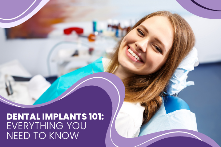Common asked questions about Dental Implants