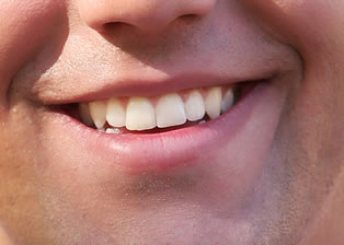 Anxiety Free Sedation