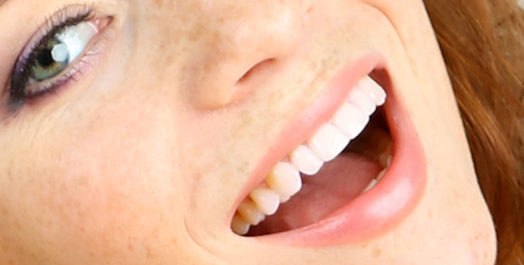 NITROUS (LAUGHING) GAS