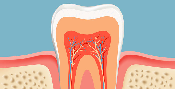 ROOT CANAL