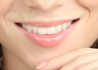 Anxiety Free Sedation