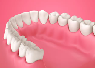 Anxiety Free Sedation